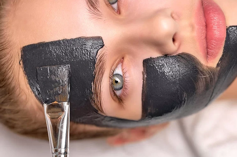 Prolaser carbon peeling tenerife